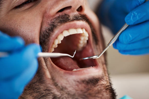 Best Cracked Tooth Emergency Dentist  in Audubon Park, KY